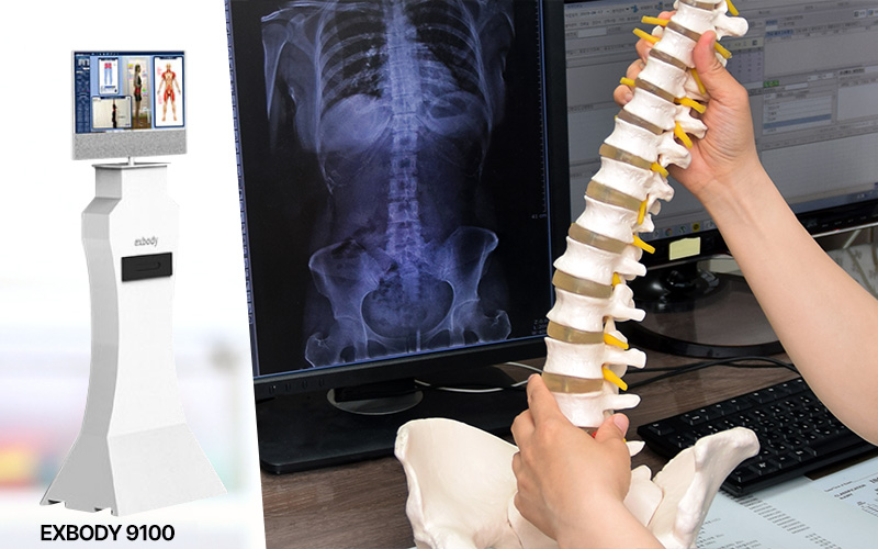 X-ray 체형분석 검사 장비